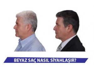 Beyaz Saç Nasıl Siyahlaşır?