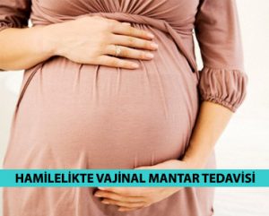 Hamilelikte Vajinal Mantar Tedavisi Nasıl Olmalı?