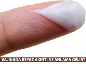 Vajinada Beyaz Akıntı Ne Anlama Gelir?